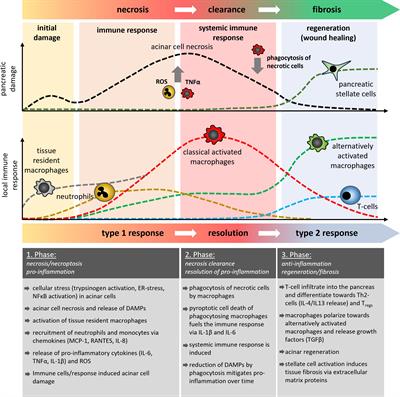 Immune response mechanisms in acute and chronic pancreatitis: strategies for therapeutic intervention
